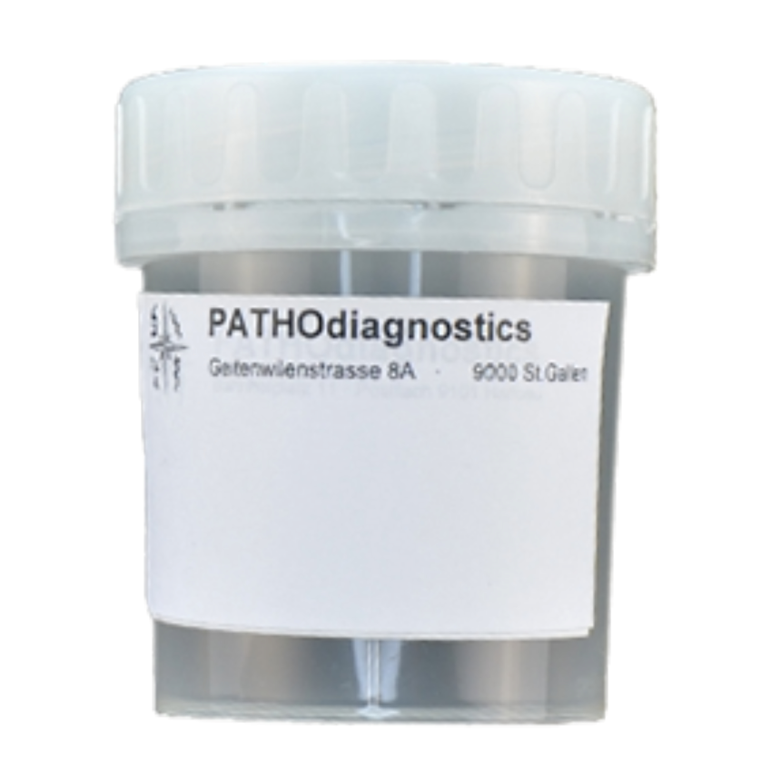 Beh&amp;#228;lter 100ml (steril) / 1 Stk.